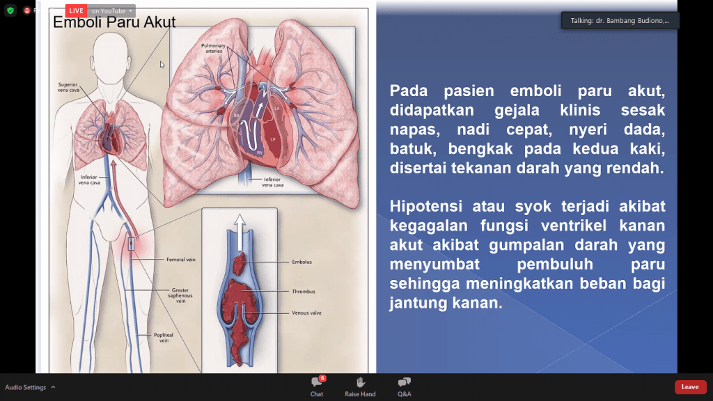 Cek, Ini Gaya Hidup Bikin Anda Sakit Jantung, Merokok Salah Satunya