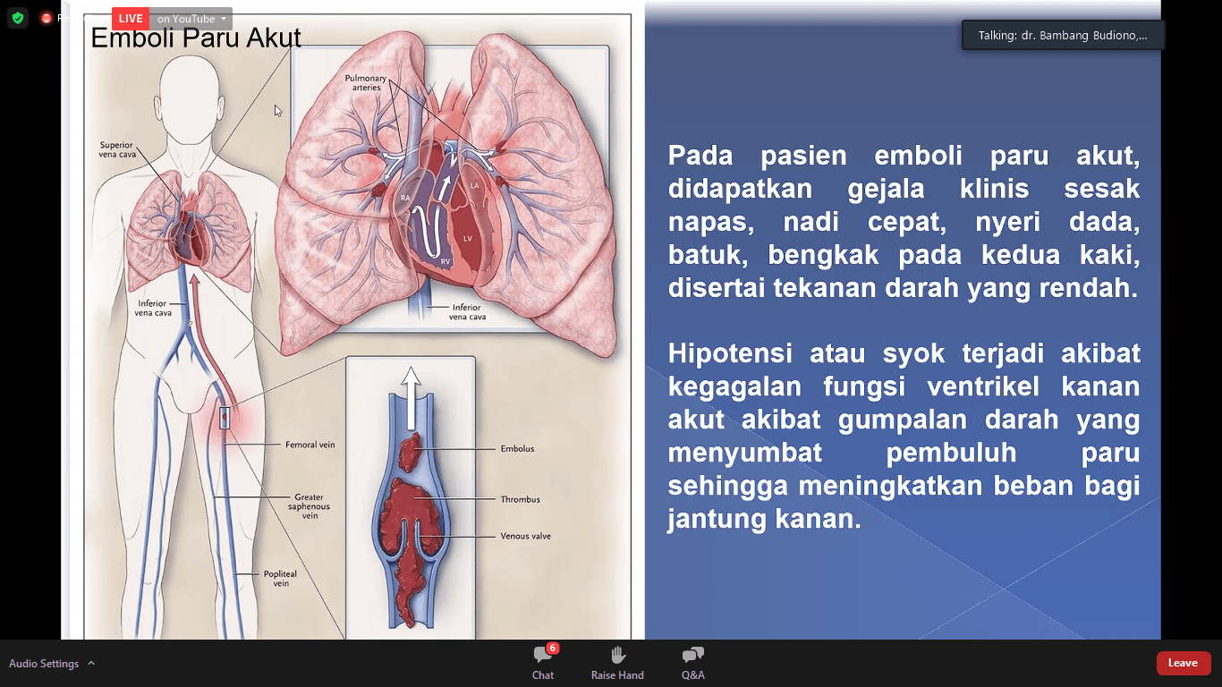Cek, Ini Gaya Hidup Bikin Anda Sakit Jantung, Merokok Salah Satunya