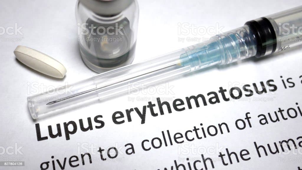 Mengenal Lebih Dekat Lupus, Si Penyakit Autoimun