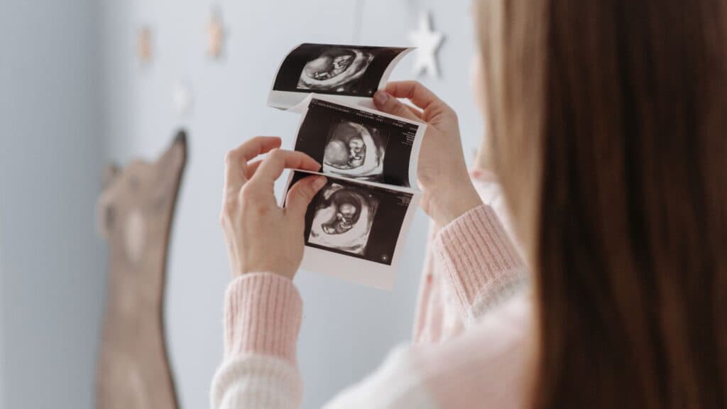HARI PEREMPUAN INTERNASIONAL: WHO Ungkap Alasan Maraknya Kematian Ibu Hamil