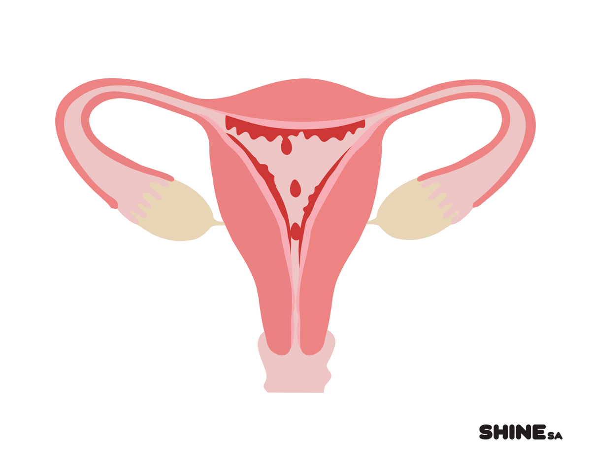 Siapa Berisiko Saat Mengalami Menstruasi