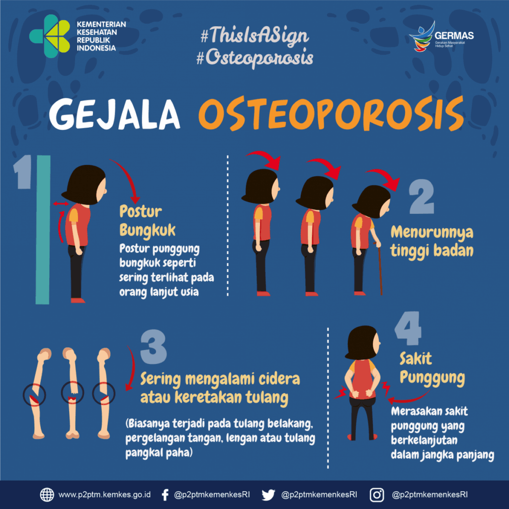 Pernah Patah Tulang Berisiko Terkena Osteoporosis, Simak Gejala Osteoporosis Lainnya