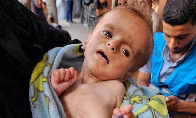 Kelaparan di Gaza, WHO Kecam Tindakan Pemiskinan