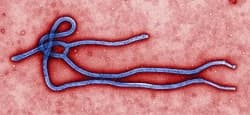 Imbauan bagi Masyarakat Indonesia atas Merebaknya Penyakit Ebola