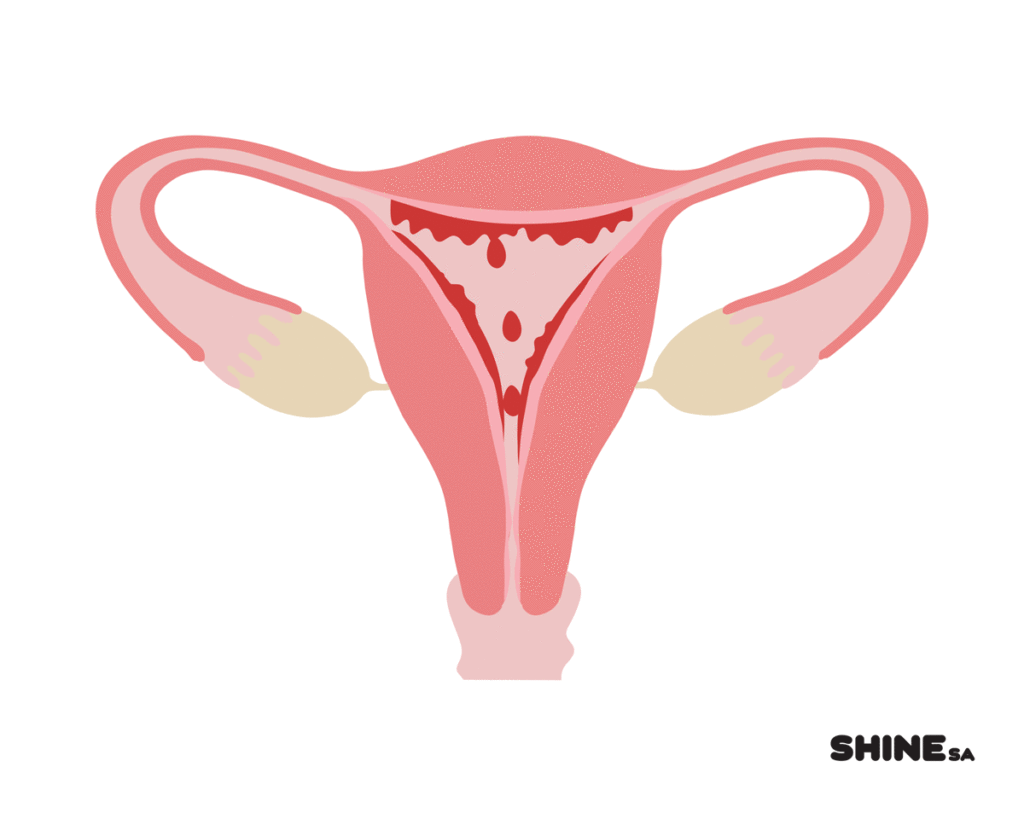Siapa Berisiko Saat Mengalami Menstruasi