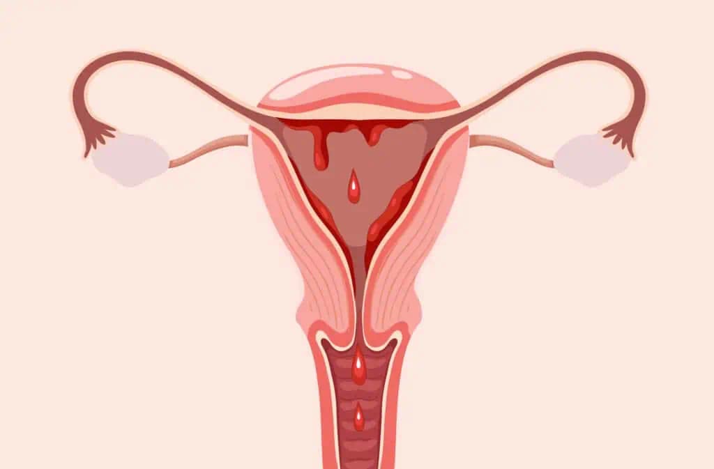Cakupan Kesehatan Menstruasi